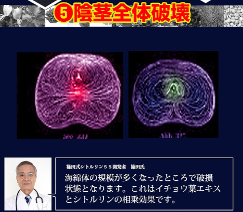 イチョウ葉エキスで「陰茎全体破壊」